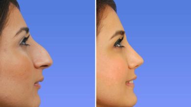 پروجکشن بینی چیست