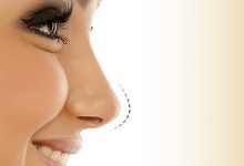 نکات مهم در جراحی بینی های گرد