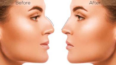 بینی نیمه فانتزی چه شکلیه