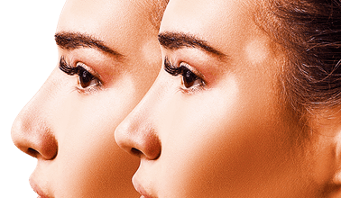 آیا میشود فقط نوک بینی را عمل کرد